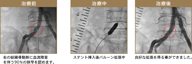 �J�e�[�e���ɂ�鎡�Ö@